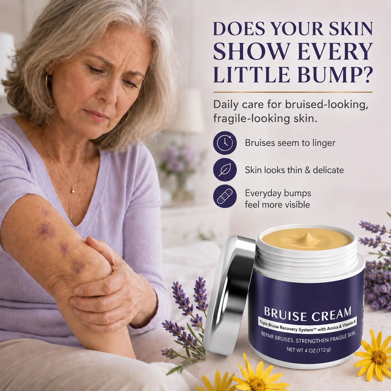 Bruise Repair & Skin-Strengthening Cream – Monthly Subscription Formula for Continuous Skin Recovery