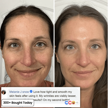 ⏰Last Day-Buy 1 Get 1 Free🔥 Calcium Multi Balm Eye Care Routine Korean Skin Care Anti-aging Cosmetics Collagen Eye Stick 9g